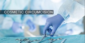 Adult Circumcision Surgery