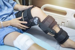 knee braces Prior Authorization