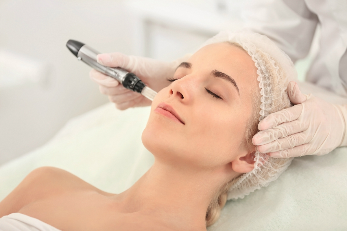 Dermapen Skin Needling Sydney - Everything You Need to Know