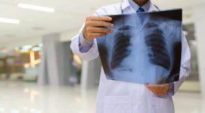 Radiology Billing